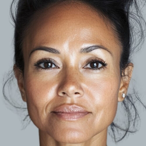 Uneven Tone Not Shifting? treatment after