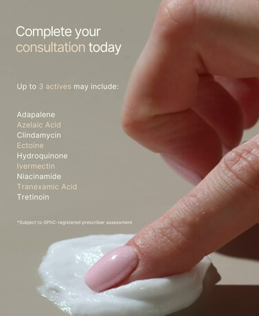 The Monderma Difference